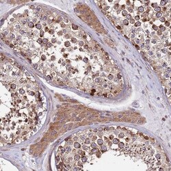 ZBTB39 Antibody, Novus Biologicals 0.1mL; Unlabeled:Antibodies, Polyclonal